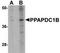 Phospholipid Phosphatase 5 antibody, TA306885, Origene, Western Blot image 