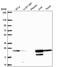 Acyl-CoA Thioesterase 6 antibody, NBP2-31708, Novus Biologicals, Western Blot image 