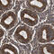 SERPINE1 MRNA Binding Protein 1 antibody, HPA020559, Atlas Antibodies, Immunohistochemistry paraffin image 