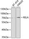 p65 antibody, A2547, ABclonal Technology, Western Blot image 