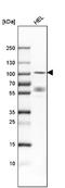 Dual Specificity Tyrosine Phosphorylation Regulated Kinase 1A antibody, NBP1-84031, Novus Biologicals, Western Blot image 