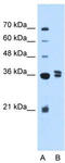 Transcription Factor B1, Mitochondrial antibody, TA335574, Origene, Western Blot image 