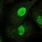 Telomerase Reverse Transcriptase antibody, HPA065897, Atlas Antibodies, Immunofluorescence image 