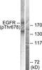 EGFR antibody, TA312536, Origene, Western Blot image 