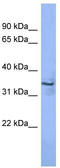 Melanoma-associated antigen 2 antibody, TA342767, Origene, Western Blot image 