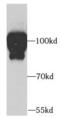 ADAM Metallopeptidase Domain 12 antibody, FNab00137, FineTest, Western Blot image 