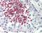 Baculoviral IAP repeat-containing protein 1 antibody, orb86690, Biorbyt, Immunohistochemistry paraffin image 