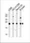 Ubiquitin C-Terminal Hydrolase L1 antibody, TA324710, Origene, Western Blot image 
