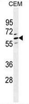 C-type lectin domain family 4 member F antibody, AP50963PU-N, Origene, Western Blot image 