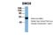 SMG8 Nonsense Mediated MRNA Decay Factor antibody, NBP1-56876, Novus Biologicals, Western Blot image 