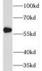 Monoamine Oxidase B antibody, FNab04972, FineTest, Western Blot image 