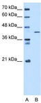 Selenophosphate Synthetase 1 antibody, TA346765, Origene, Western Blot image 