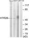 5-Hydroxytryptamine Receptor 2B antibody, OAAF04758, Aviva Systems Biology, Western Blot image 