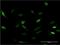 Cyclin Dependent Kinase 19 antibody, H00023097-M06, Novus Biologicals, Immunocytochemistry image 