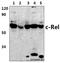 REL Proto-Oncogene, NF-KB Subunit antibody, GTX66625, GeneTex, Western Blot image 