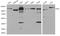 Hexokinase 2 antibody, A01389-1, Boster Biological Technology, Western Blot image 