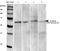 Calcium Voltage-Gated Channel Auxiliary Subunit Gamma 2 antibody, orb99091, Biorbyt, Western Blot image 
