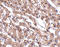 Metastasis-associated in colon cancer protein 1 antibody, A04732, Boster Biological Technology, Immunohistochemistry paraffin image 