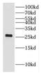 Dehydrogenase/Reductase 11 antibody, FNab02370, FineTest, Western Blot image 