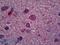 Oligodendrocyte Transcription Factor 2 antibody, LS-B6029, Lifespan Biosciences, Immunohistochemistry paraffin image 
