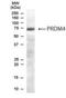 PR/SET Domain 4 antibody, NB100-1469, Novus Biologicals, Western Blot image 