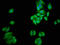 UDP Glucuronosyltransferase Family 1 Member A1 antibody, CSB-PA025570LA01HU, Cusabio, Immunofluorescence image 