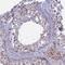 Meiosis 1 Associated Protein antibody, HPA045420, Atlas Antibodies, Immunohistochemistry paraffin image 