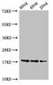 UDP-glucuronosyltransferase 1-1 antibody, orb53887, Biorbyt, Western Blot image 
