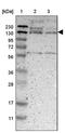 DENN Domain Containing 4C antibody, PA5-53255, Invitrogen Antibodies, Western Blot image 