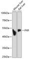 Nuclear receptor subfamily 1 group I member 2 antibody, 16-843, ProSci, Western Blot image 