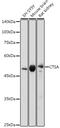 Cathepsin A antibody, GTX32490, GeneTex, Western Blot image 
