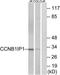 Cyclin B1 Interacting Protein 1 antibody, TA312550, Origene, Western Blot image 