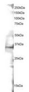 Suppressor Of Cytokine Signaling 1 antibody, TA302691, Origene, Western Blot image 
