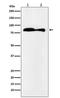 VPS35 Retromer Complex Component antibody, M01644, Boster Biological Technology, Western Blot image 