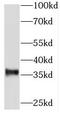 Tripartite Motif-Containing 51 antibody, FNab08202, FineTest, Western Blot image 