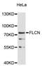 Folliculin antibody, A11849, ABclonal Technology, Western Blot image 