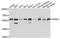 Protein Phosphatase 5 Catalytic Subunit antibody, STJ111951, St John