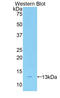 Reprimo, TP53 Dependent G2 Arrest Mediator Homolog antibody, LS-C296220, Lifespan Biosciences, Western Blot image 