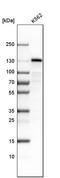 Stonin-2 antibody, PA5-51821, Invitrogen Antibodies, Western Blot image 
