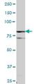 Diacylglycerol kinase alpha antibody, H00001606-B01P, Novus Biologicals, Western Blot image 