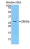 Spectrin alpha chain, brain antibody, LS-C303770, Lifespan Biosciences, Western Blot image 