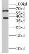 Plastin 3 antibody, FNab06559, FineTest, Western Blot image 