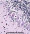 Transient Receptor Potential Cation Channel Subfamily C Member 5 antibody, abx027595, Abbexa, Immunohistochemistry paraffin image 