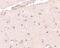 BRCA1/BRCA2-Containing Complex Subunit 3 antibody, 4331, ProSci, Immunohistochemistry paraffin image 