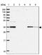 F-Box And Leucine Rich Repeat Protein 14 antibody, PA5-62862, Invitrogen Antibodies, Western Blot image 