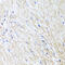 L-2-Hydroxyglutarate Dehydrogenase antibody, 23-337, ProSci, Immunohistochemistry paraffin image 