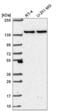 SH3 Domain And Tetratricopeptide Repeats 1 antibody, NBP2-58624, Novus Biologicals, Western Blot image 