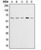 Akt antibody, MBS821784, MyBioSource, Western Blot image 