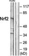 ETS Transcription Factor ERG antibody, orb49143, Biorbyt, Western Blot image 