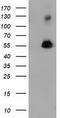 Sequestosome-1 antibody, CF502130, Origene, Western Blot image 